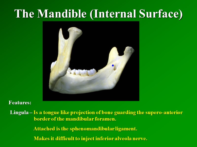 The Mandible (Internal Surface)   Features:  Lingula – Is a tongue like